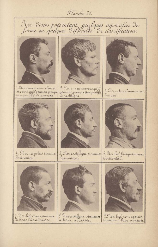 Identification anthropométrique : instructions signalétiques, Album, Imprimerie administrative de Melun, 1893. © Alphonse Bertillon