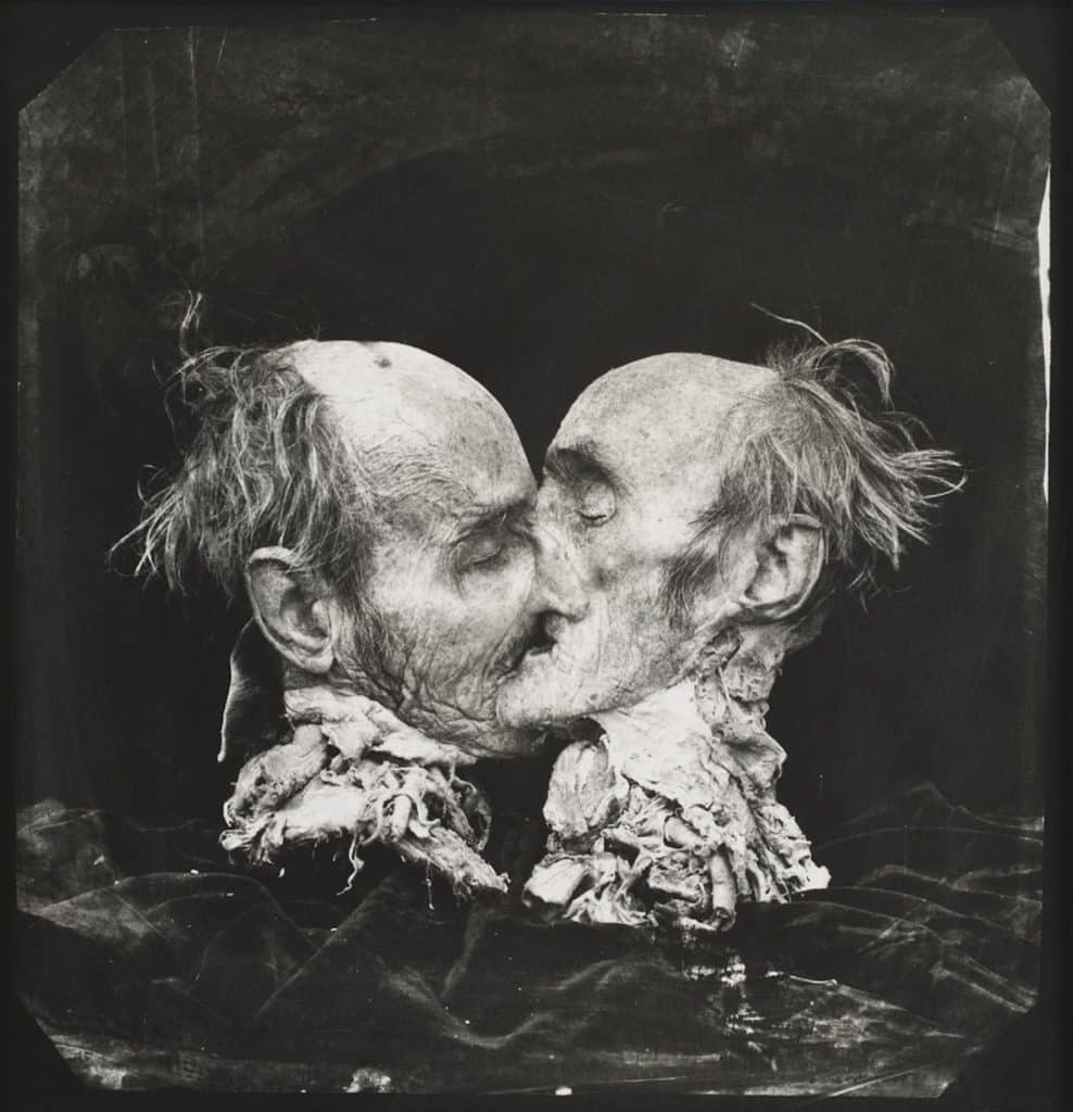 Le baiser, New-Mexico, 1982 © Joel-Peter Witkin. Courtesy Baudoin Lebon.