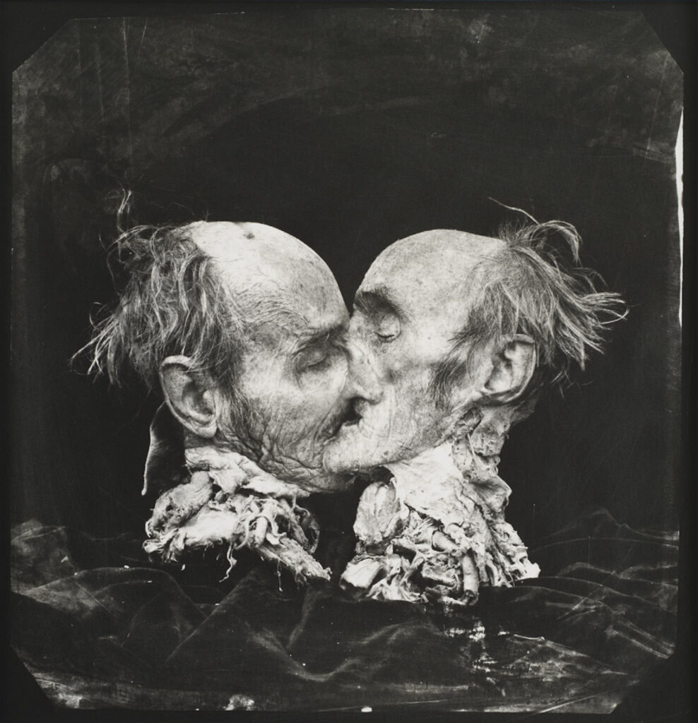 Le baiser, New-Mexico, 1982 © Joel-Peter Witkin. Avec l'aimable autorisation de Baudoin Lebon.