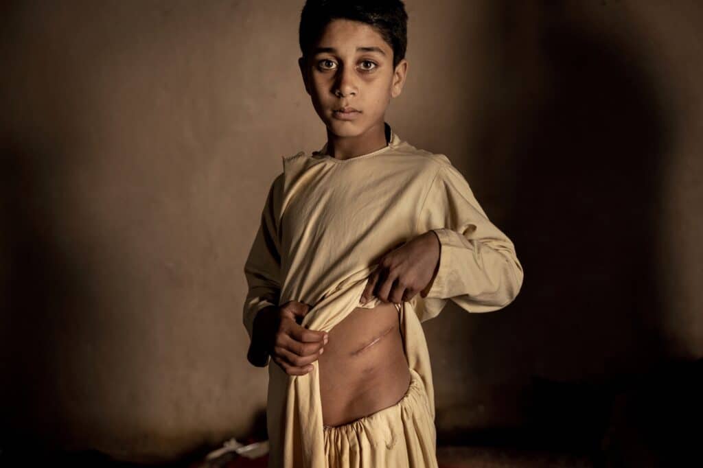The Price of Peace in Afghanistan © Mads Nissen, World Press Photo Story of the Year