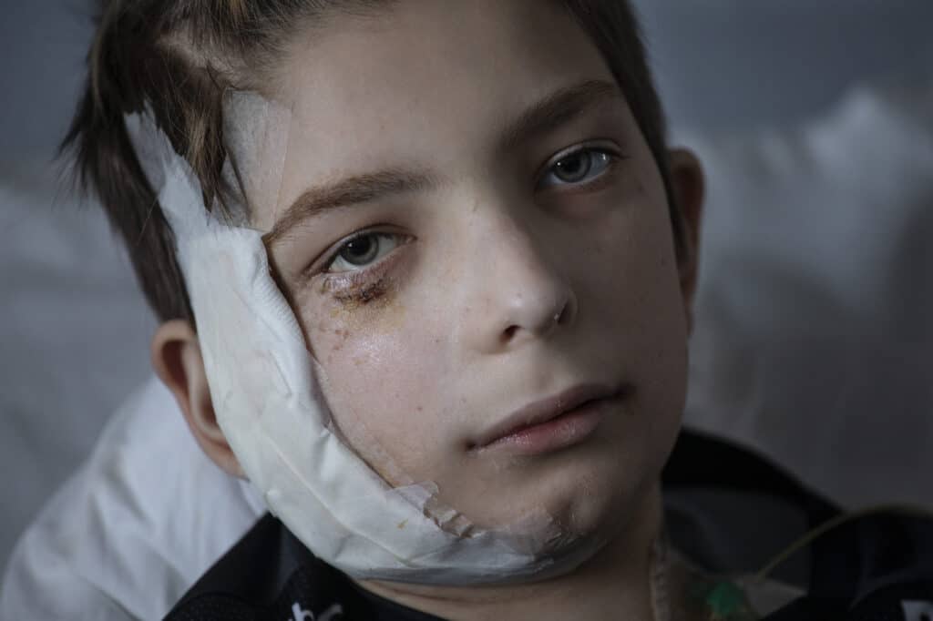 À l'hôpital central d'Ohmatdyt, Vovo, 13 ans, a perdu son père dans la voiture lorsqu'ils ont été attaqués. Il a encore une balle logée dans le dos qui nécessite une intervention chirurgicale. © Paula Bronstein pour le Times